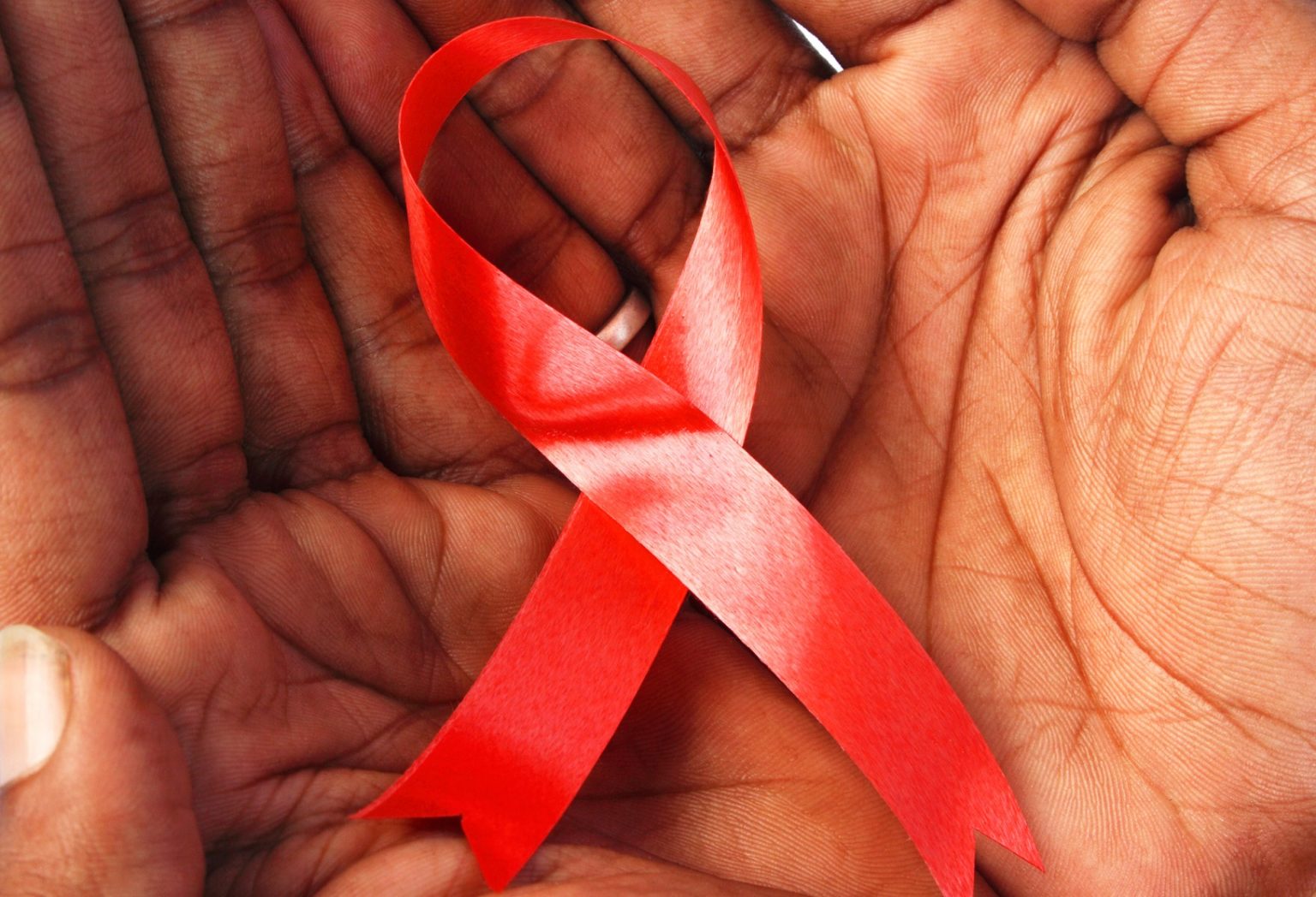 Она расселась спид. Она расселась спид. Она расселась спид. Вич спид. Вич и туберкулез картинки.