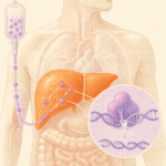 One-Time Gene Editing Shows Yearlong Cholesterol Reduction in Humans